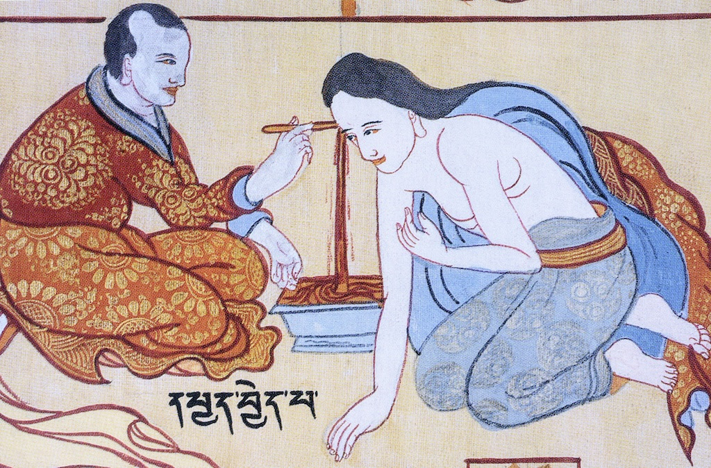Image of page Chinese Bloodletting